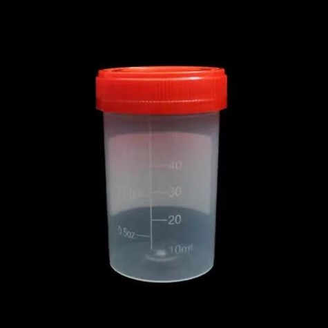 Urine Specimen Container Cup for Diagnostic Lab
